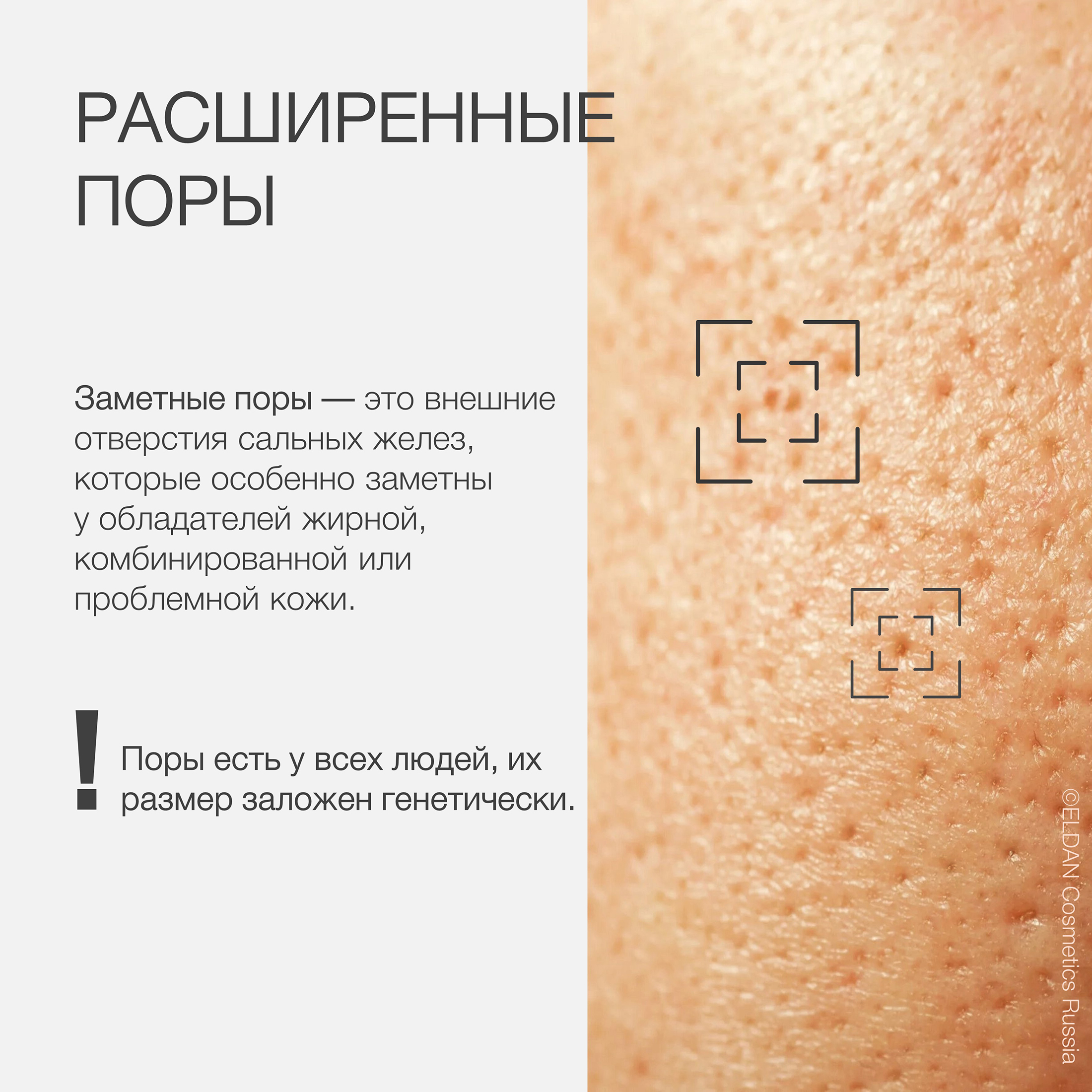 Пост сужение пор 2.jpg Пост сужение пор 2.jpg
